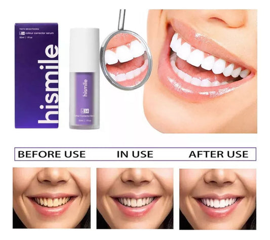 HISMILES Crema Dental - Golden Group Enterprise