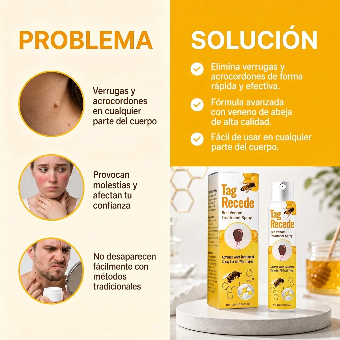 Tag Recede | Elimina Verrugas De Forma Rápida, Segura Y Sin Cicatrices