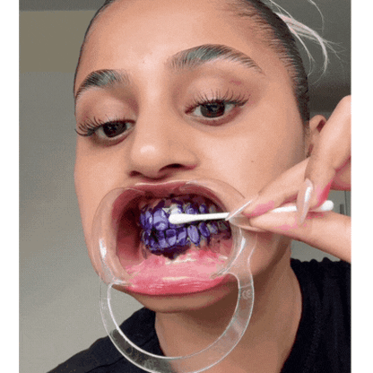 Hismile® v34 | Blanqueador Dental con Tecnología de Corrección de Color y Fórmula Sin Sensibilidad