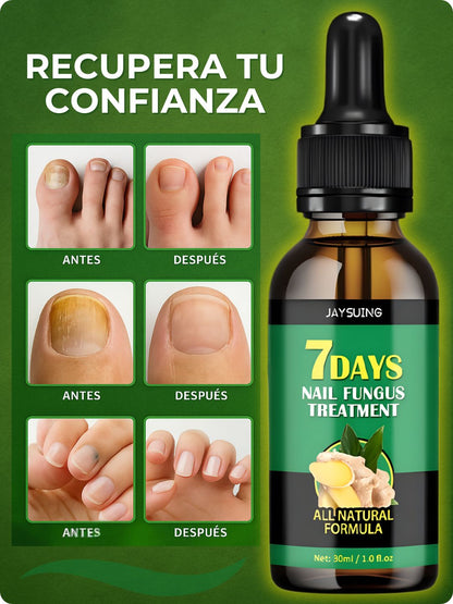 Serum 7 Days | Reparador de Uñas Antihongos - Golden Group Enterprise